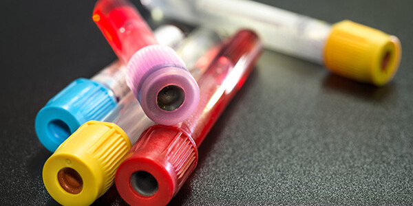 Image representing BOOK A BLOOD TEST